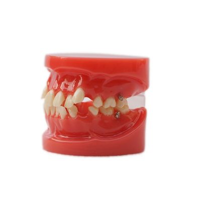 Đào tạo sử dụng răng răng dạy mô hình chức năng răng mô hình chỉnh nha không có đệm