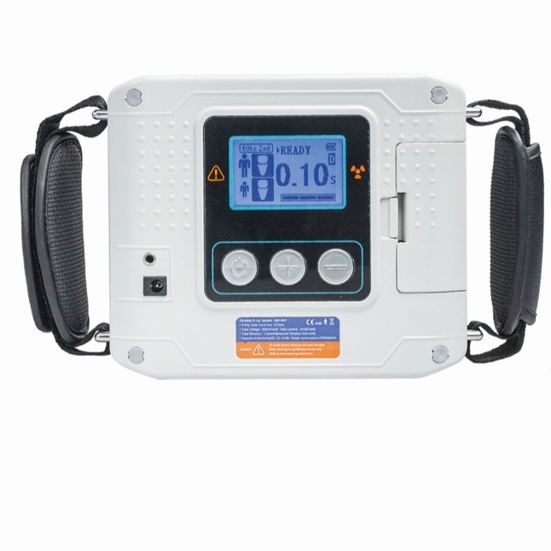 Máy X-quang di động không dây, Máy X-quang nha khoa cầm tay, Máy X-quang nha khoa di động nhẹ